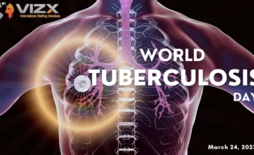 Think, Test and Treat Tuberculosis